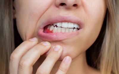 Fogínybetegségek: az íny és a fogágy megbetegedései