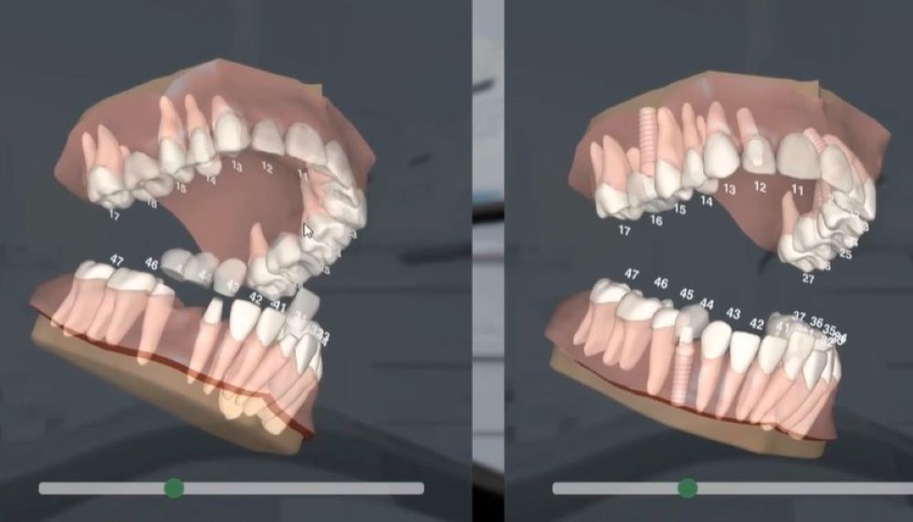 A Dentalmaster animációit a páciens a mobiljá is magával viheti
