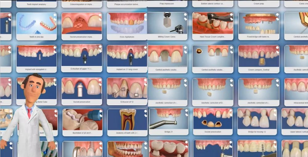 A Dentalmaster több mint 400 animációval segíti a jobb megértést