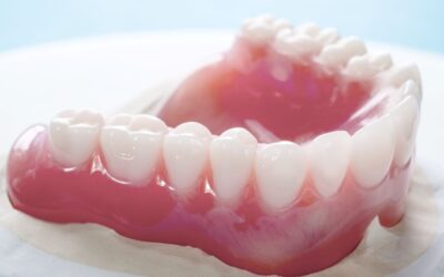 Ideiglenes fogsor és ideiglenes fogpótlás: legfontosabb tudnivalók