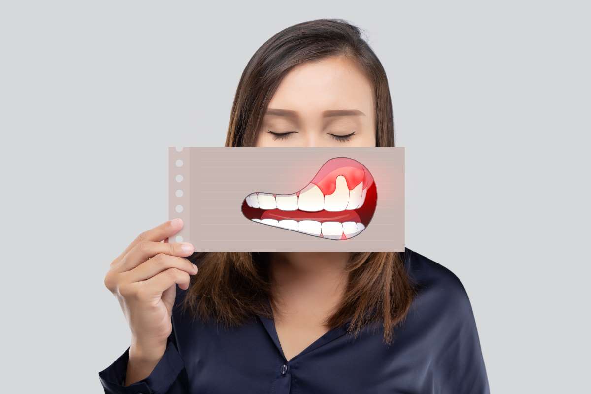 hogy alakul ki a fogágy gyulladás?
