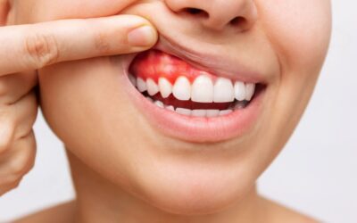 Milyen fogínyvédő vitaminokat érdemes szedni?