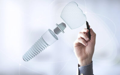 Forradalom a fogászatban: Hogyan alakítja át a mesterséges intelligencia az implantációs kezeléseket?