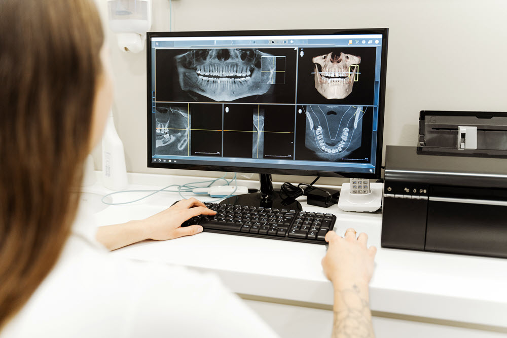 cbct-mesterseges-intelligencia A mesterséges intelligencia (AI) megoldást kínálhat az artefaktumok hatékony csökkentésére.