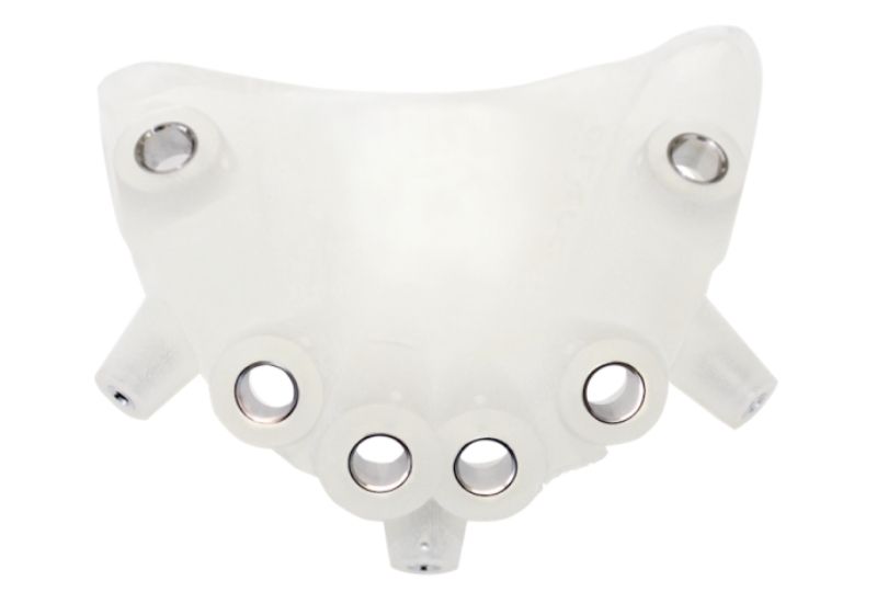 A paciens számára egyedi fogászati sablon készül, amely vezeti a fúrósort.