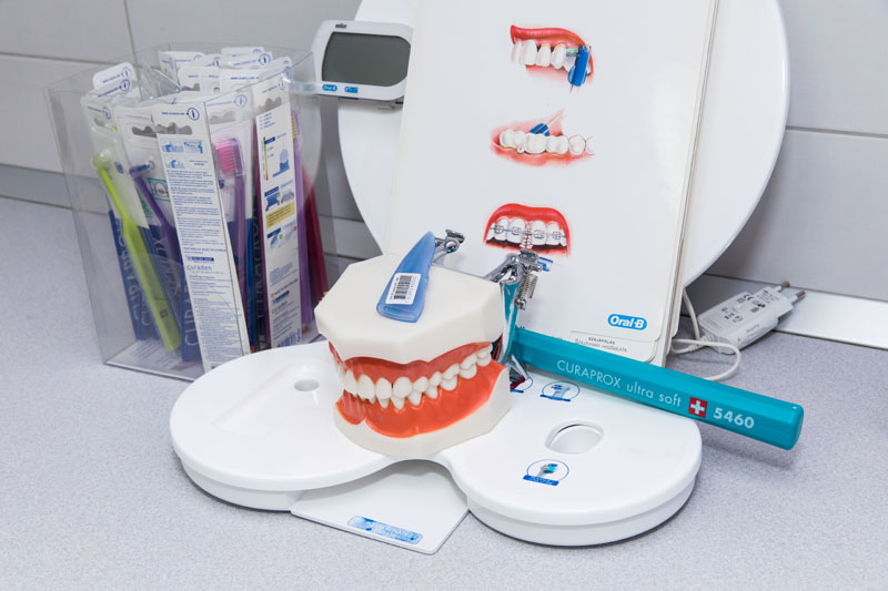 Speciális fog ragasztó cement a válasz a kérdésre, hogy mivel lehet fogat ragasztani